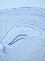 /album/fotogaleria-medium-spiny-neuron-labeled-with-dii-and-genegun/hipo-represent-4x-09-jpg/